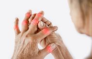 a person holding their sore hand, with red areas at the knuckles